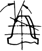 �X݆�����g(sh��)�Z(y��)�A���X݆�͈A���X݆��